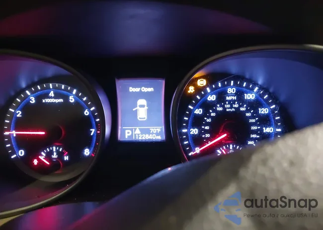 5XYZU3LB2EG199628: 38101308