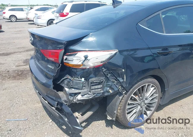 KMHD04LBXJU451335: 42651772